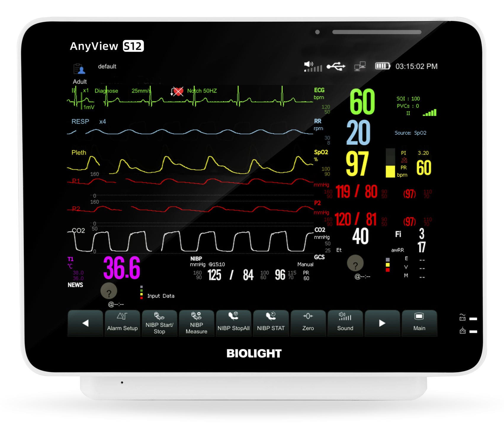 Patient Monitor Portable – S12-image